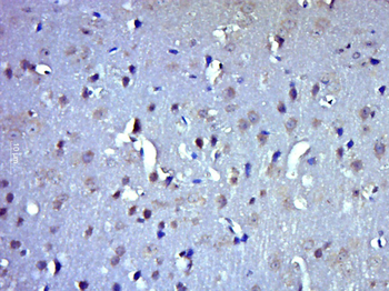 ICMT Rabbit Polyclonal Antibody