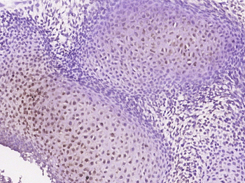 CKLFH8 Rabbit Polyclonal Antibody