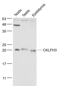 CKLFH3 Rabbit Polyclonal Antibody