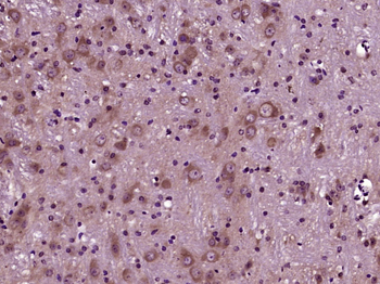 CKLFH6 Rabbit Polyclonal Antibody
