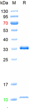 Recombinant human FCGRT&B2M Heterodimer protein, C-His (HEK293)