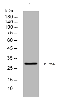 TMEM56/TLCD4 Rabbit Polyclonal Antibody