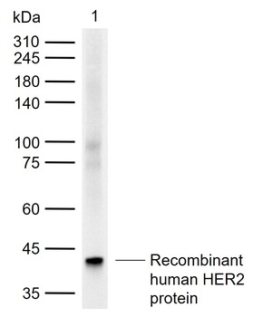 ERBB2/HER2 Mouse Monoclonal Antibody