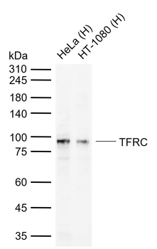 TFRC Mouse Monoclonal Antibody