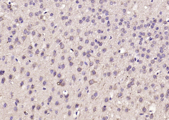 CNKSR2/KSR2 Rabbit Polyclonal Antibody