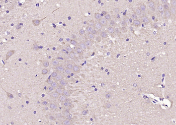 CNKSR2/KSR2 Rabbit Polyclonal Antibody