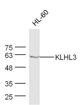 KLHL3 Rabbit Polyclonal Antibody
