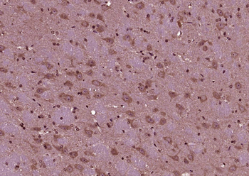 KIAA1199 Rabbit Polyclonal Antibody