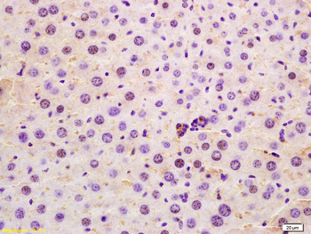 SRRM2 Rabbit Polyclonal Antibody