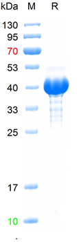 Recombinant human CPT1A protein, N-His