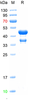 Recombinant human ADA2 protein, N-GST