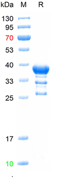 Recombinant human DPP1 protein, N-GST