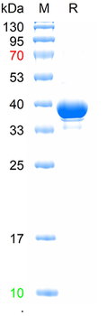 Recombinant human Keratocan protein, N-His
