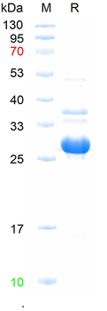 Recombinant human IL27RA protein, N-His