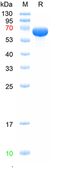 Recombinant Influenza B (B/Phuket/3073/2013) Nucleoprotein, C-His