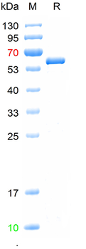 Recombinant Influenza A virus H1N1 (A/Wisconsin/67/2022)/(A/Victoria/2570/2019)/(A/Wisconsin/588/2019) Nucleoprotein, C-His