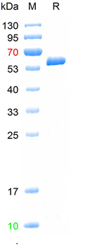 Recombinant Influenza A virus H1N1(A/Victoria/4897/2022)Nucleoprotein, C-His