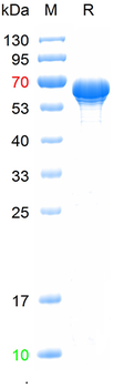 Recombinant Influenza B (B/Austria/1359417/2021) Nucleoprotein, C-His