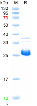 Recombinant human IGF1R protein, N-His