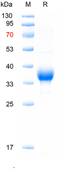 Recombinant human GPR126 protein, N-His