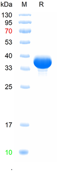 Recombinant human TPH1 protein, N-His