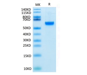 Recombinant human ROR2 protein, C-His-Avi (HEK293), Biotin conjugated