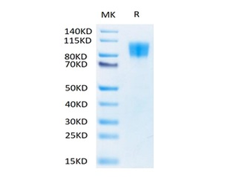 Recombinant human PDGF R Beta protein, C-His-Avi (HEK293), Biotin conjugated