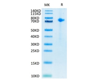 Recombinant human Notch 1 protein, C-His-Avi (HEK293), Biotin conjugated