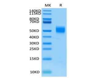 Recombinant human MICB protein, C-His-Avi (HEK293), Biotin conjugated