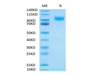 Recombinant human IL-17RA protein, C-hFc-Avi (HEK293), Biotin conjugated