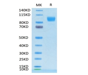 Recombinant human ErbB2 / Her2 protein, C-His-Avi (HEK293), Biotin conjugated