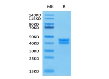 Recombinant human GPA33 / A33 protein, C-His-Avi (HEK293), Biotin conjugated