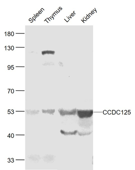 CCDC125 Rabbit Polyclonal Antibody