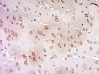 CCDC94 Rabbit Polyclonal Antibody