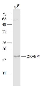 CRABP1/Retinol binding protein Rabbit Polyclonal Antibody