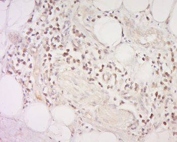 CCDC68 Rabbit Polyclonal Antibody