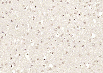 CCDC7 Rabbit Polyclonal Antibody