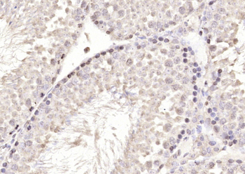 CCDC7 Rabbit Polyclonal Antibody