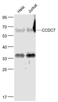 CCDC7 Rabbit Polyclonal Antibody