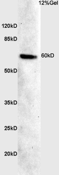 CDKAL1 Rabbit Polyclonal Antibody