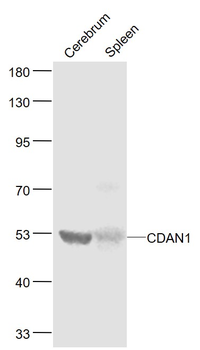 CDAN1 Rabbit Polyclonal Antibody