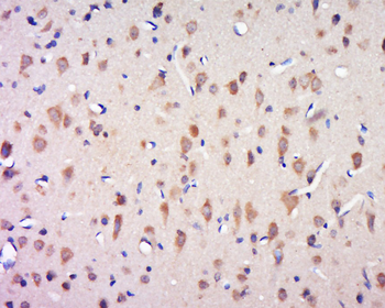 CCDC124 Rabbit Polyclonal Antibody