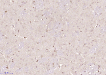 HSPB2 Rabbit Polyclonal Antibody