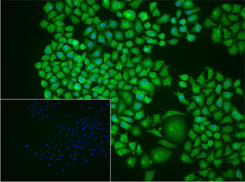 COMMD1 Rabbit Polyclonal Antibody