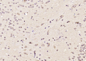 COMMD1 Rabbit Polyclonal Antibody