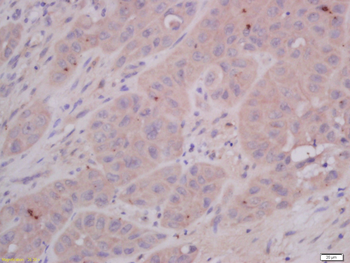 COMMD4 Rabbit Polyclonal Antibody