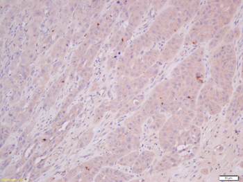 COMMD4 Rabbit Polyclonal Antibody