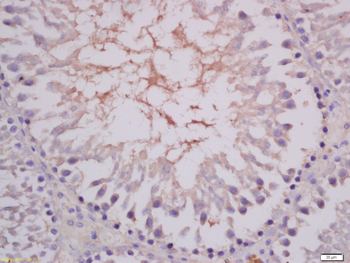 COMMD4 Rabbit Polyclonal Antibody