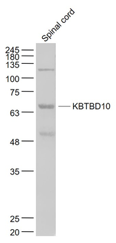 KBTBD10 Rabbit Polyclonal Antibody