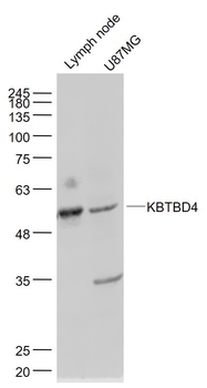 KBTBD4 Rabbit Polyclonal Antibody